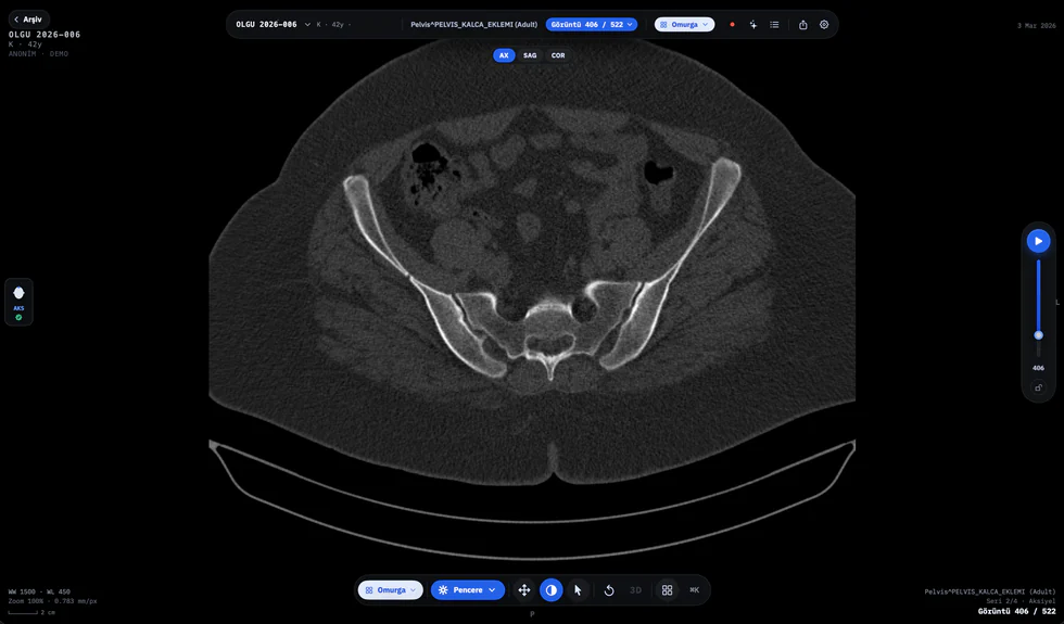 dicom-axle aksiyel görünüm