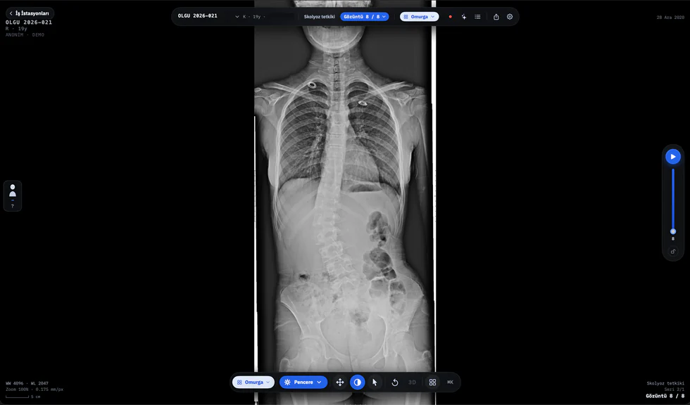 dicom-axle koronal görünüm